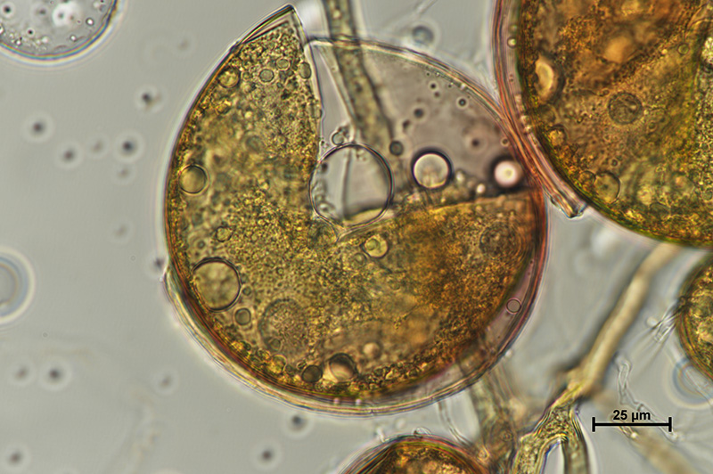Microscopic image 3 of DAOM 212349 - Rhizophagus irregularis