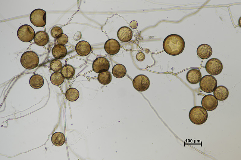 Microscopic image 1 of DAOM 212349 - Rhizophagus irregularis