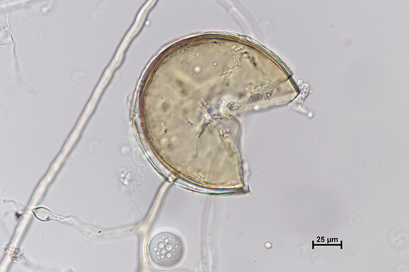 Microscopic image 2 of DAOM 212349 - Rhizophagus irregularis