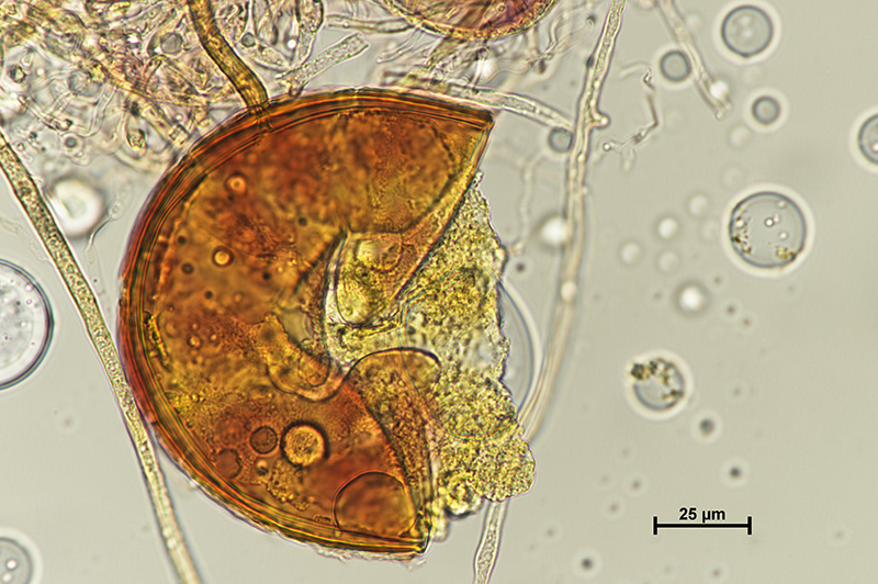 Microscopic image 3 of DAOM 234179 - Rhizophagus irregularis