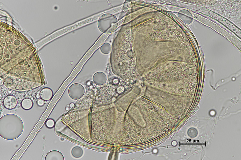 Image microscopique 2 de DAOM 234179 - Rhizophagus irregularis