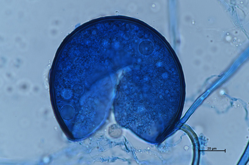 Microscopic image 4 of DAOM 234180 - Rhizophagus irregularis