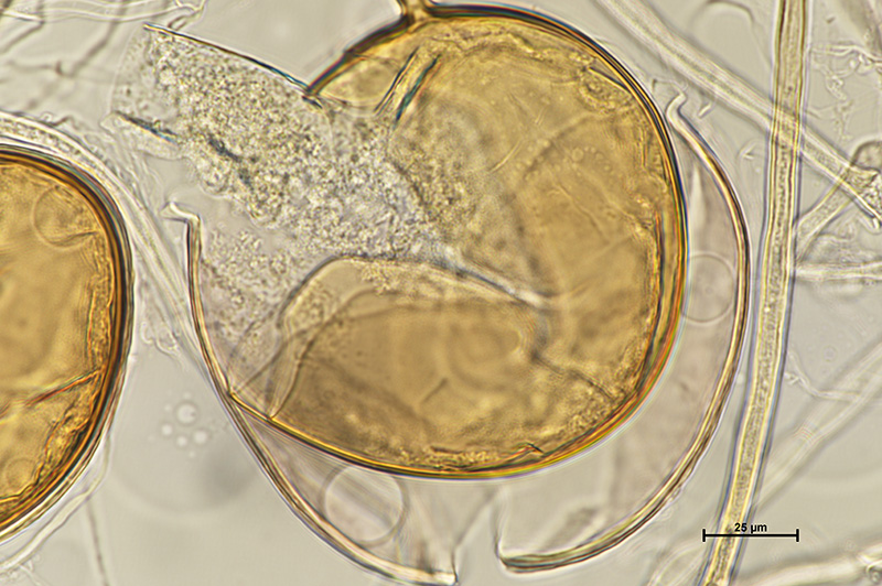 Microscopic image 3 of DAOM 234180 - Rhizophagus irregularis