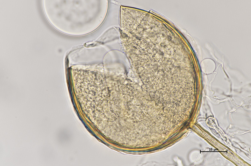 Microscopic image 2 of DAOM 234180 - Rhizophagus irregularis