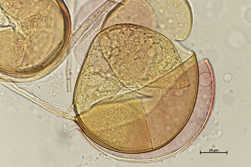 Microscopic image 3 of DAOM 234181 - Rhizophagus irregularis