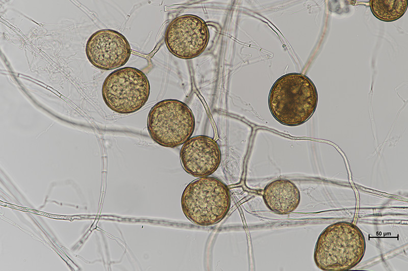 Microscopic image 1 of DAOM 234181 - Rhizophagus irregularis