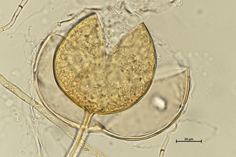 Microscopic image 3 of DAOM 229457 - Rhizophagus irregularis