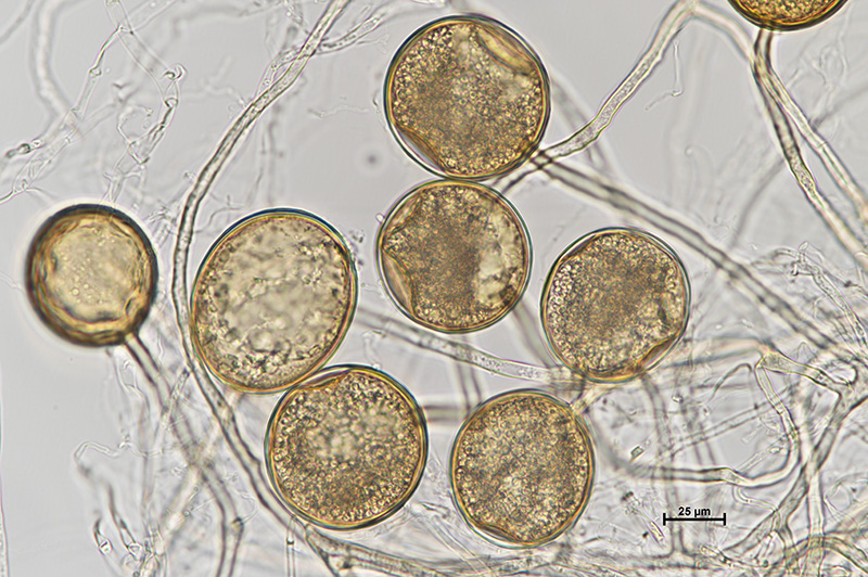 Microscopic image 1 of DAOM 229457 - Rhizophagus irregularis