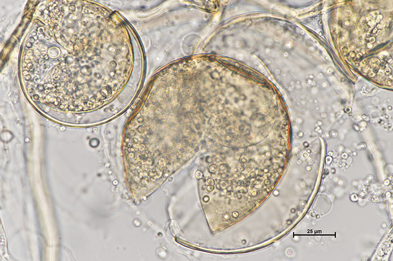 Microscopic image 2 of DAOM 229457 - Rhizophagus irregularis