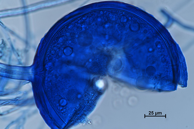 Microscopic image 4 of DAOM 234281 - Rhizophagus clarus