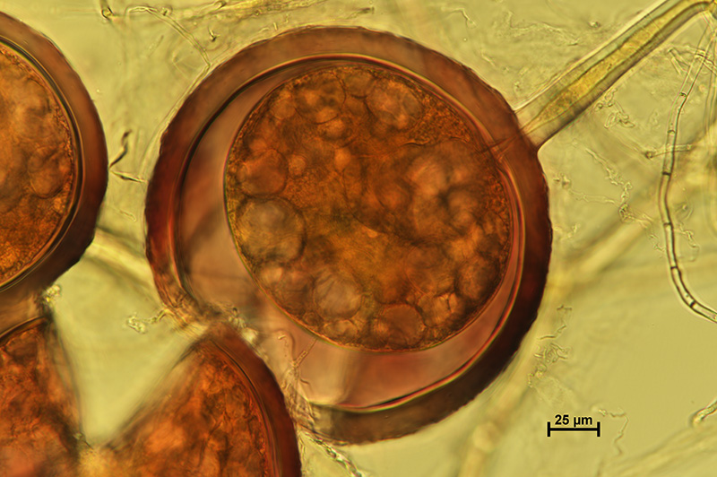 Microscopic image 3 of DAOM 234281 - Rhizophagus clarus