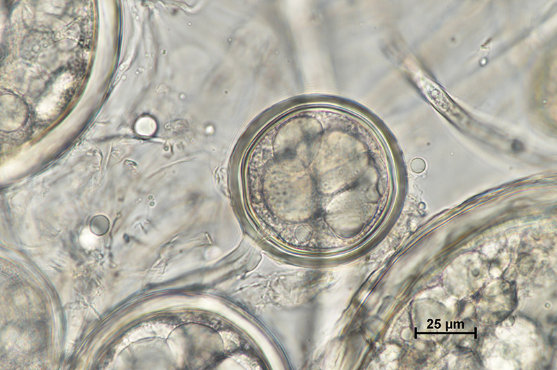 Microscopic image 1 of DAOM 234281 - Rhizophagus clarus