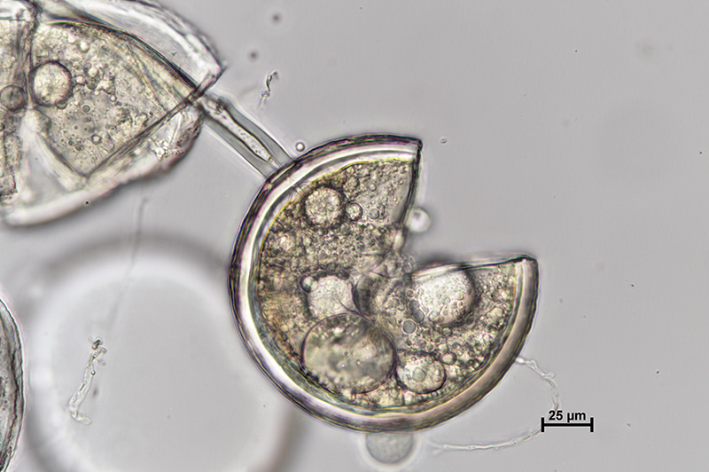 Microscopic image 2 of DAOM 234281 - Rhizophagus clarus