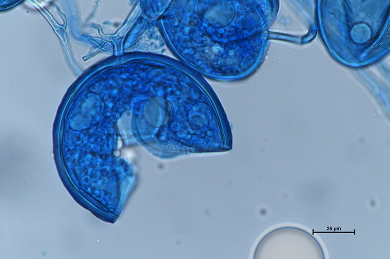 Microscopic image 4 of DAOM 227022 - Oehlia diaphana