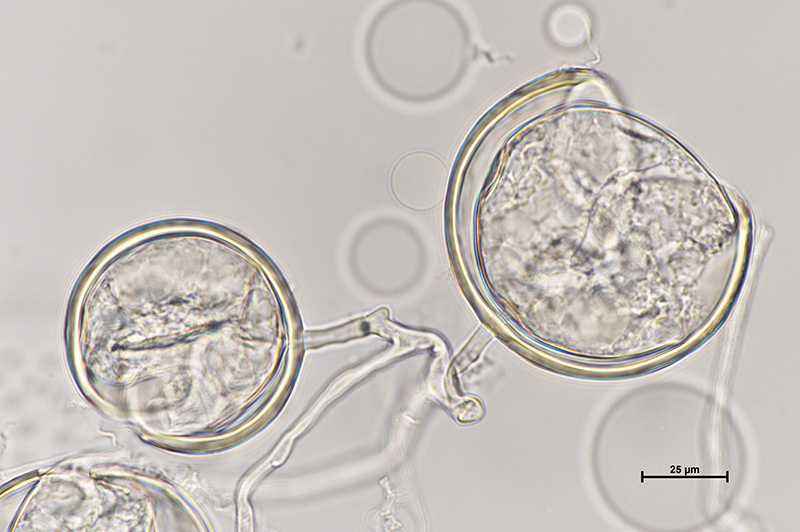 Microscopic image 2 of DAOM 227022 - Oehlia diaphana