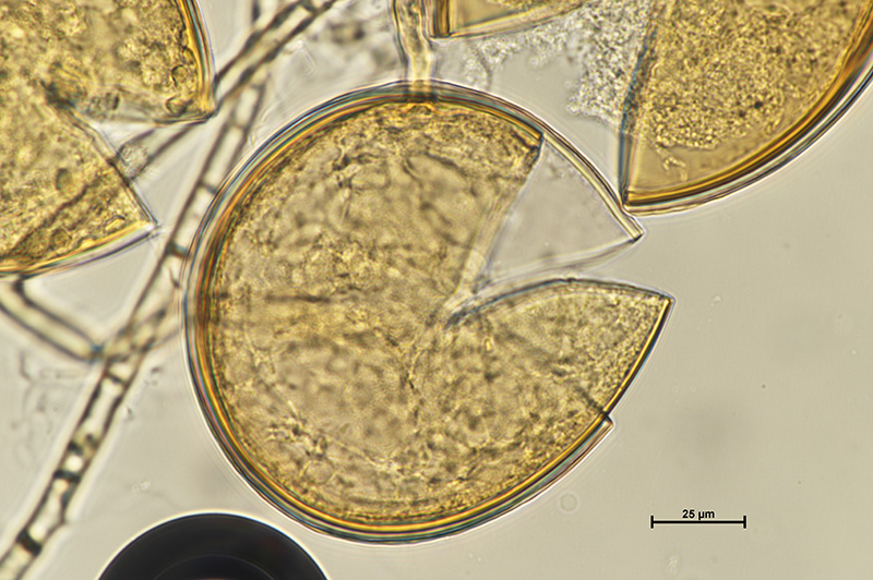Microscopic image 3 of DAOM 197198 - Rhizophagus irregularis