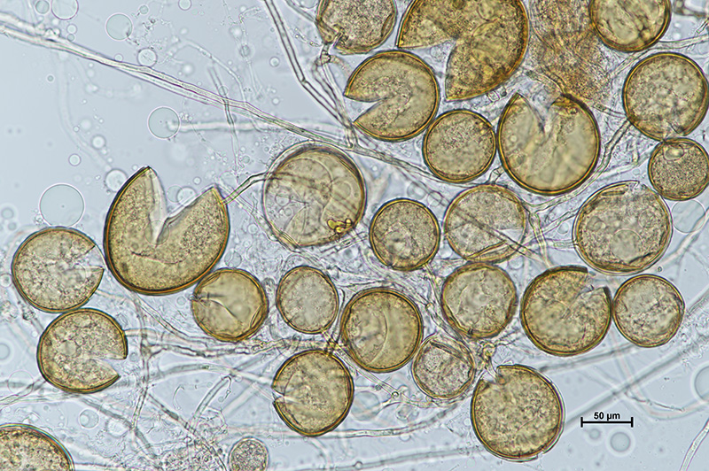 Microscopic image 1 of DAOM 197198 - Rhizophagus irregularis