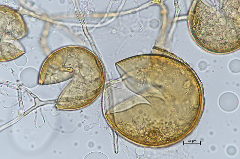 Microscopic image 2 of DAOM 197198 - Rhizophagus irregularis