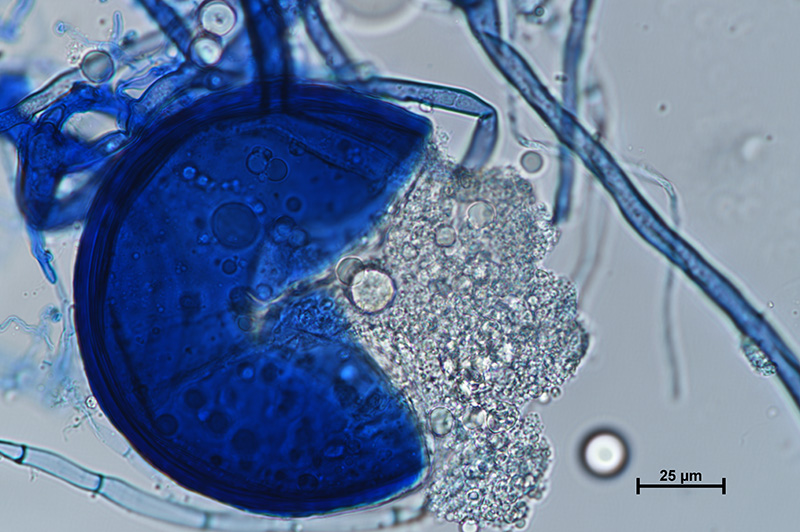 Microscopic image 4 of DAOM 229456 - Rhizophagus irregularis
