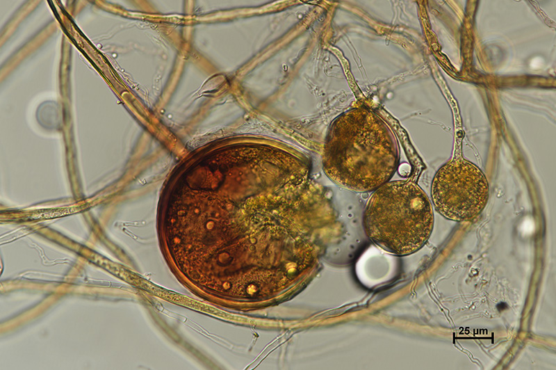 Microscopic image 3 of DAOM 229456 - Rhizophagus irregularis