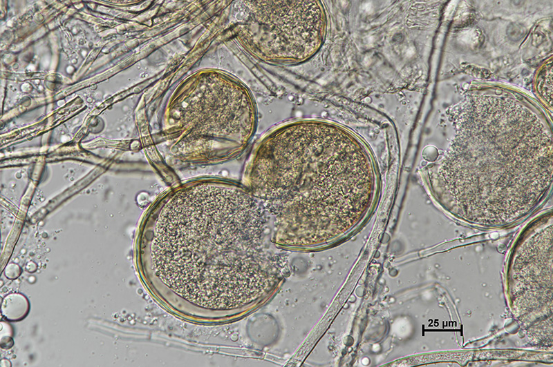 Microscopic image 2 of DAOM 229456 - Rhizophagus irregularis
