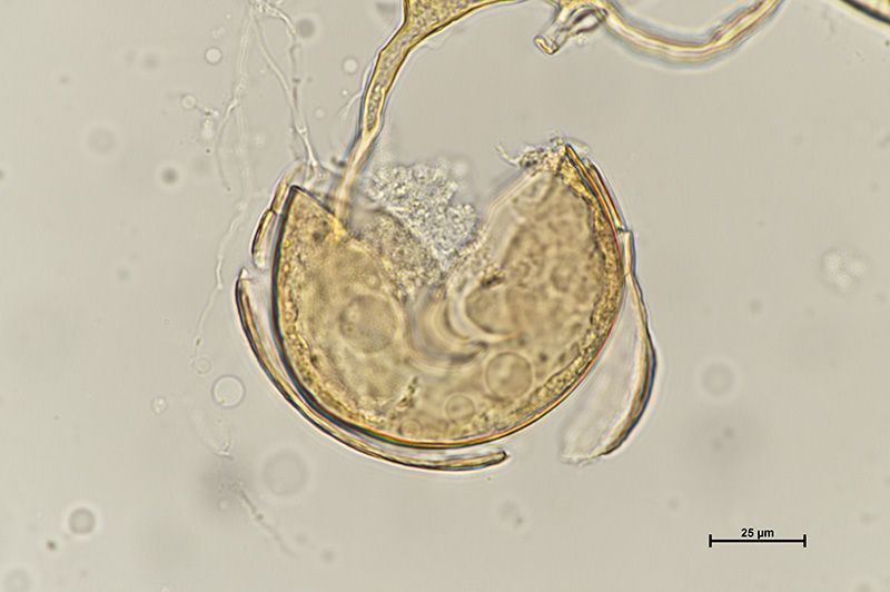 Microscopic image 3 of DAOM 229455 - Rhizophagus irregularis