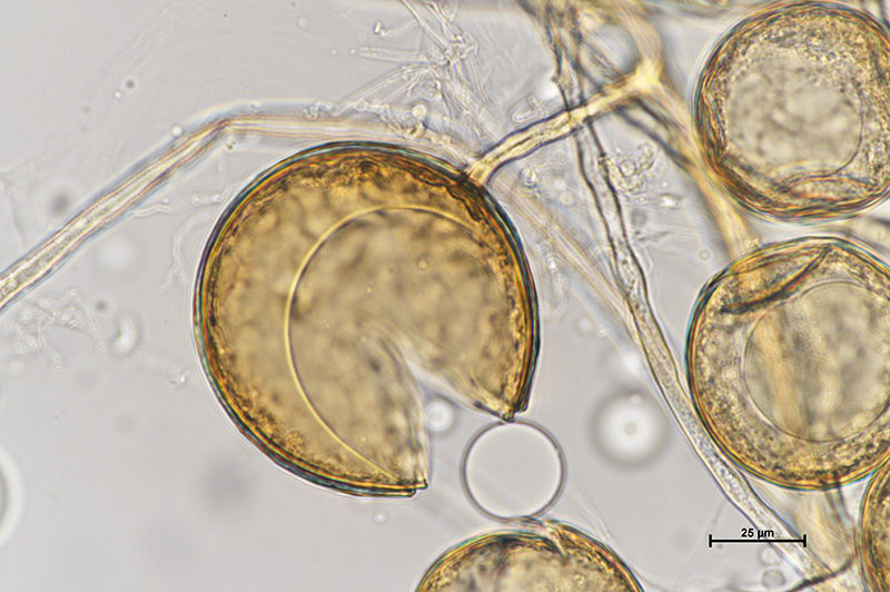 Microscopic image 2 of DAOM 229455 - Rhizophagus irregularis