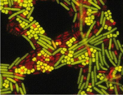 Yellow, green, Red and orange bacteria strand.