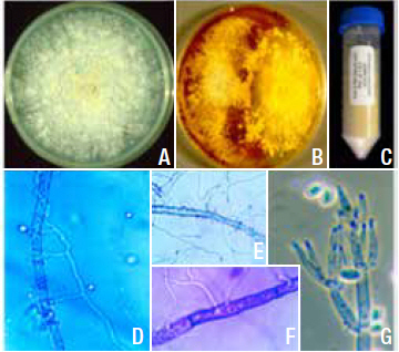 Photo montage showing a culture plate, a test tube, and microscope images of ACM941