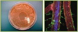 Pseudomonas fluorescens strain BRG100 - in petri dish and under microscope