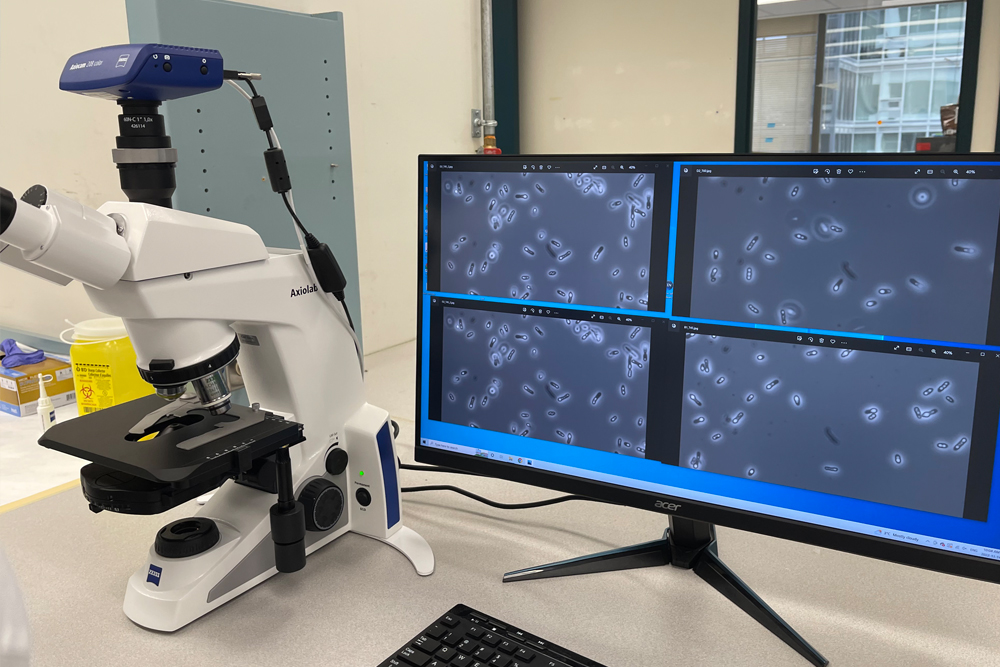Un microscope à côté d'un écran d'ordinateur affichant des bactéries
